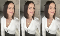 skincare BBL laser