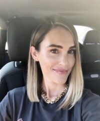 kasey botox fillers